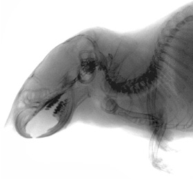 Biological skeleton X-ray imaging