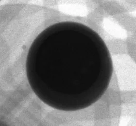 BGA solder joint magnified X-ray inspection image | Matsusada Precision