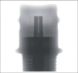Insert molding (Injection molding) parts X-ray inspection image | Matsusada Precision
