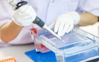 Research and Development