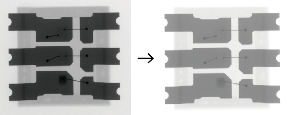 X-ray images comparing before and after using the brightness control