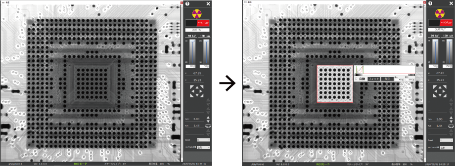 X-ray images comparing before and after using the ROI function