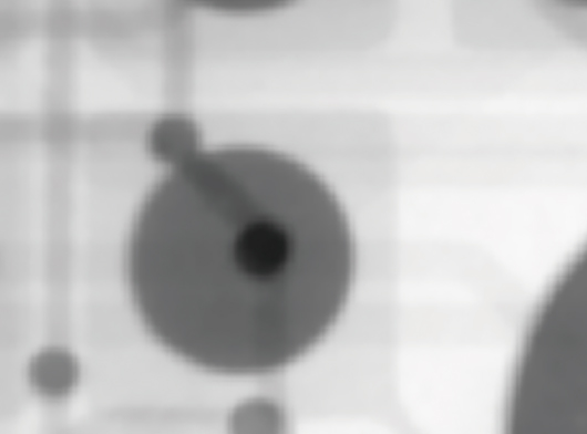 Filtered (smoothed) X-ray image