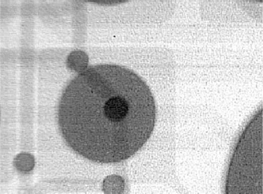 Filtered (Edge enhancement) X-ray image