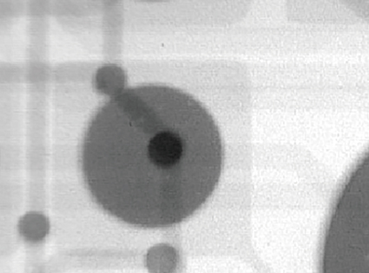 Filtered (Unsharpened) X-ray image