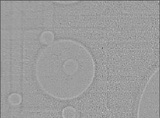 Filtered (Laplacian) X-ray image