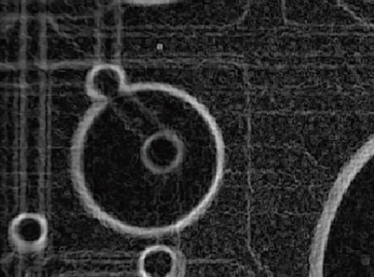 Filtered (Prewitt/Sobel) X-ray image