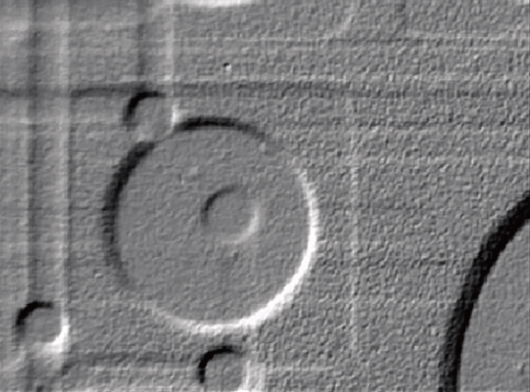 Filtered (Emboss) X-ray image