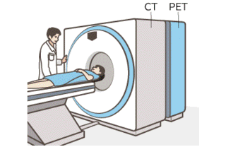 PET-CT